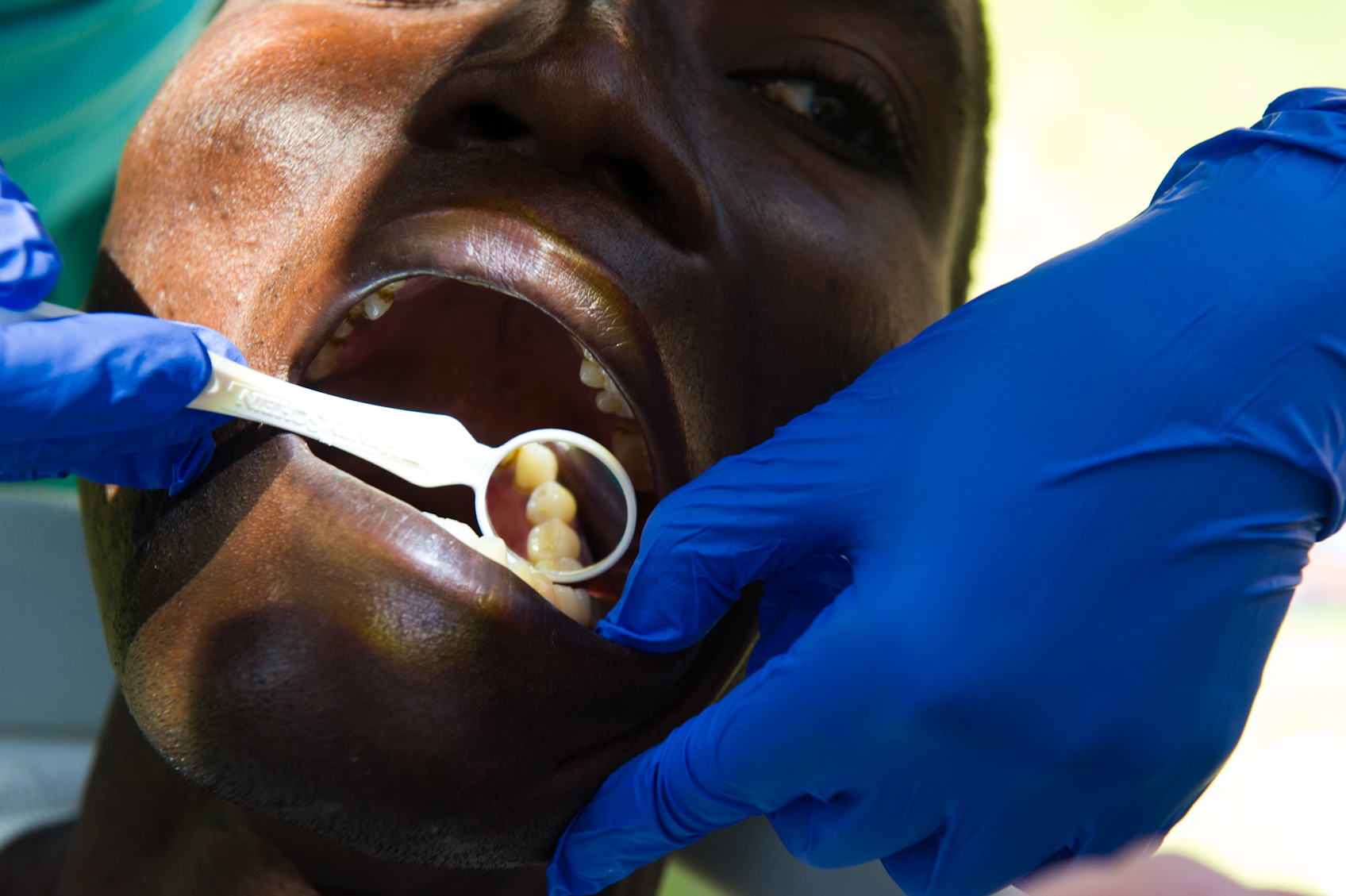 robert_whitman_haitian_dentistry_outreach_17